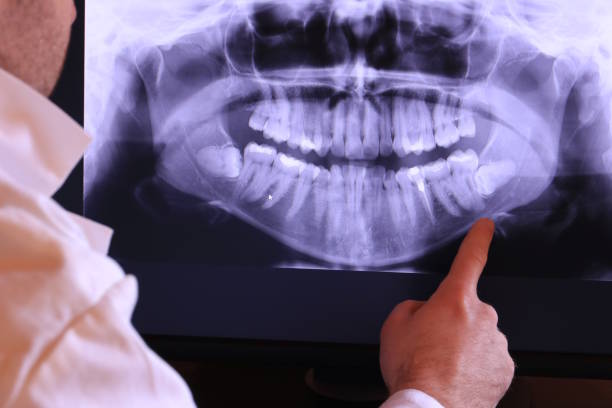 Best Emergency Tooth Extraction  in Boulevard Gardens, FL