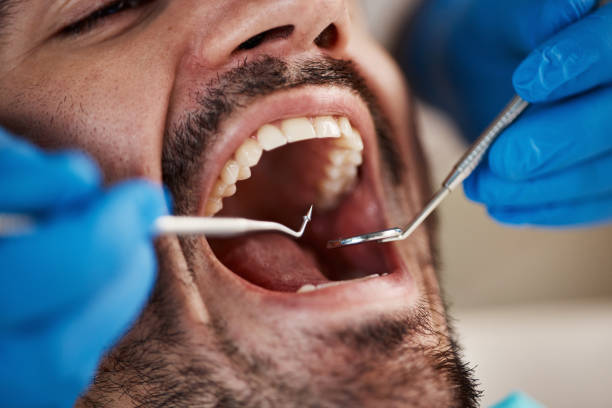 Best Emergency Dentist Near Me  in Boulevard Gardens, FL